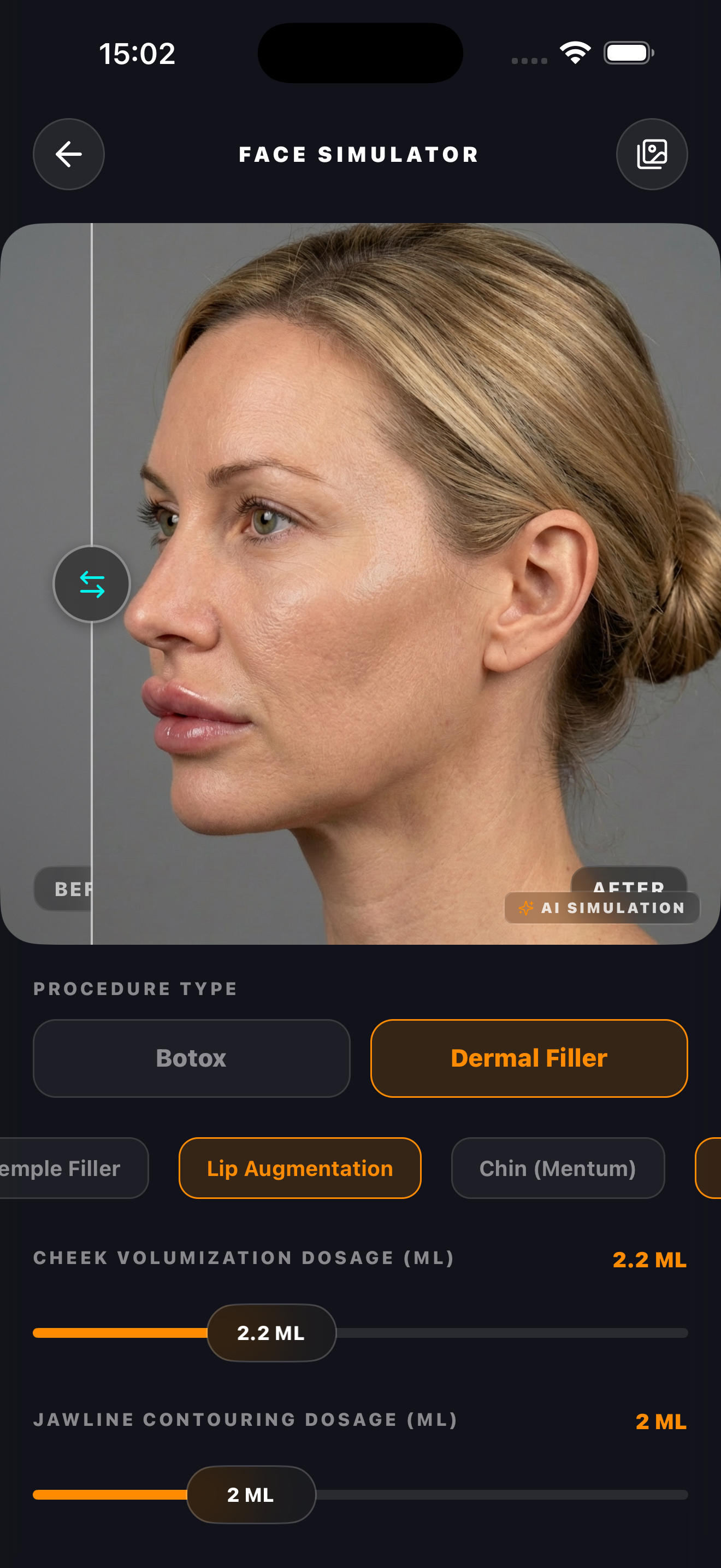 Anthropometric Analysis: The Scientific Blueprint of Facial Balance